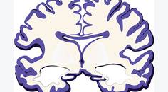 Diversity in Aging Related Neuroimaging Research