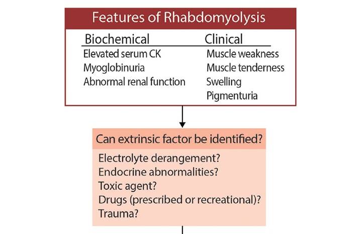 Neuromuscular Notes Rhabdomyolysis