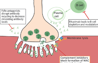 semaglutide and myasthenia gravis Next-Gen Myasthenia Gravis Treatments